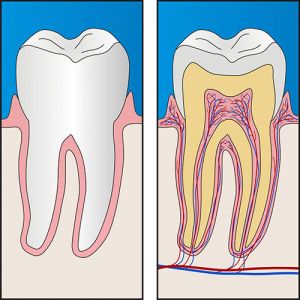 Root Canal Treatment | Dentist Preston
